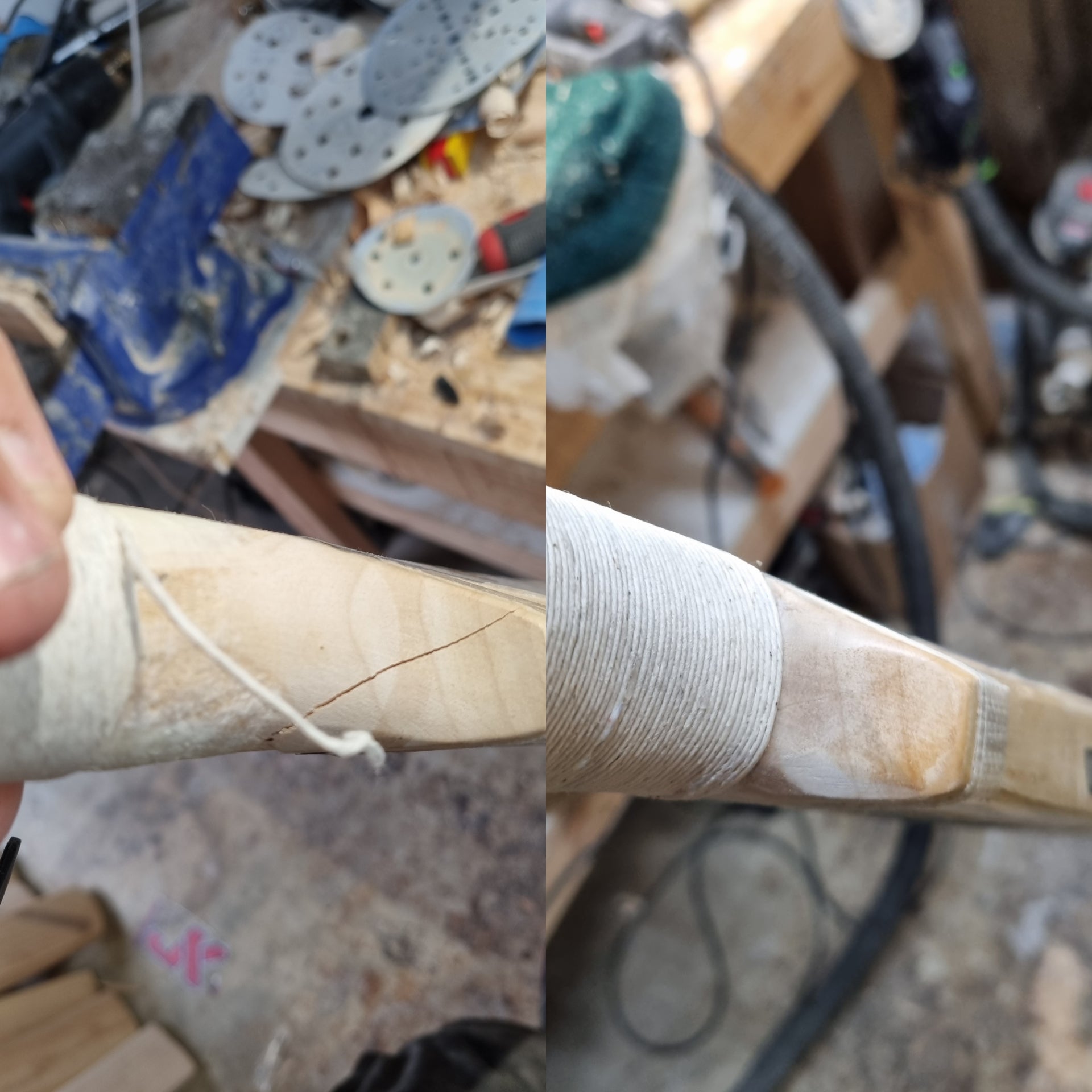 Shoulder Repair